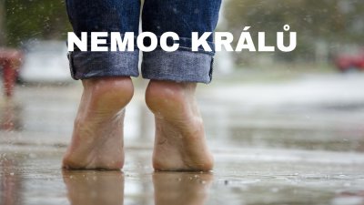 Nemoc DNA: Jaké jsou příznaky, příčiny, prevence, a co léčba? | ARNO.cz - obuv s tradicí